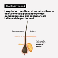 Shampooing Anti-Inconfort Scalp Advanced L'Oréal 500ml -Soins Capillaires scalp adavanced antiinconfort 48244.1684847785